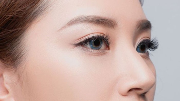 Cut excess fat the under lower eyelids