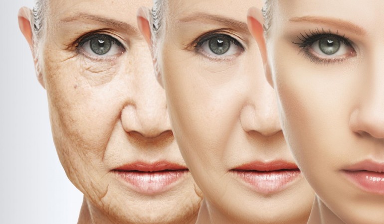 Ưu – Khuyết điểm khi tiêm Botox